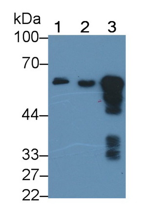 Monoclonal Antibody to Amylase Alpha 2B, Pancreatic (AMY2B)