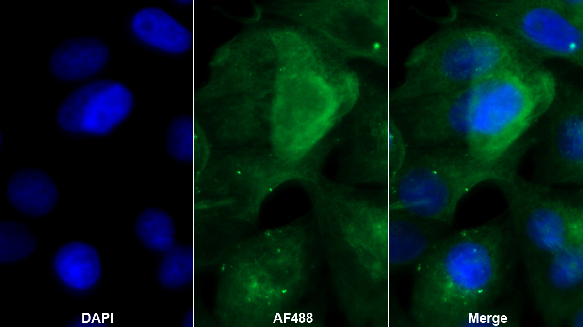 Monoclonal Antibody to CUB And Zona Pellucida Like Domains Protein 1 (CUZD1)