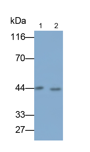 Monoclonal Antibody to Ly1 Antibody Reactive Homolog (LYAR)