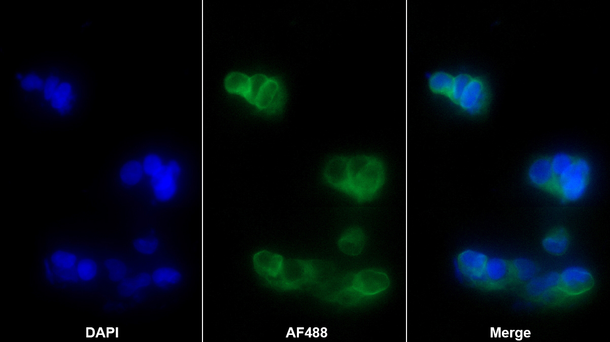 Monoclonal Antibody to Complement Component 4d (C4d)