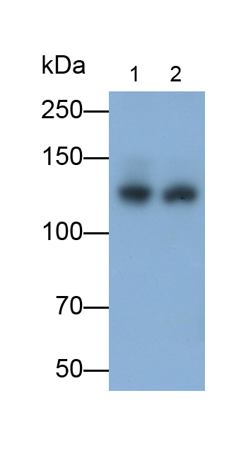 Monoclonal Antibody to Complement Component 3c (C3c)