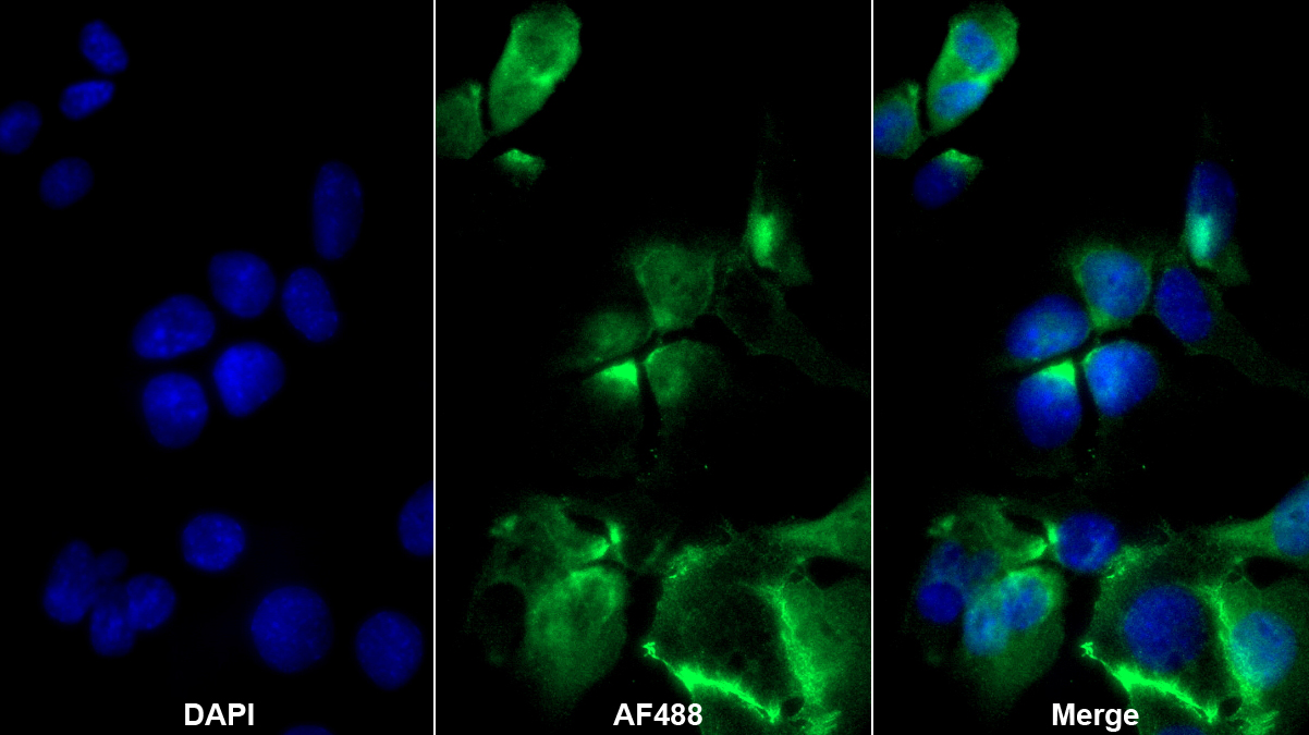 Polyclonal Antibody to Activated Leukocyte Cell Adhesion Molecule (ALCAM)