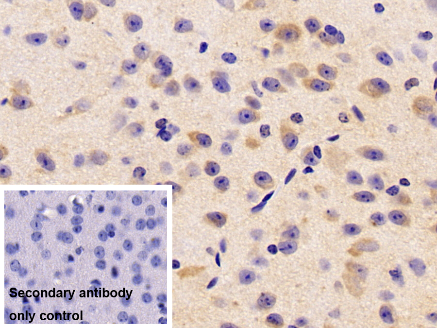 Polyclonal Antibody to Brain Derived Neurotrophic Factor (BDNF)