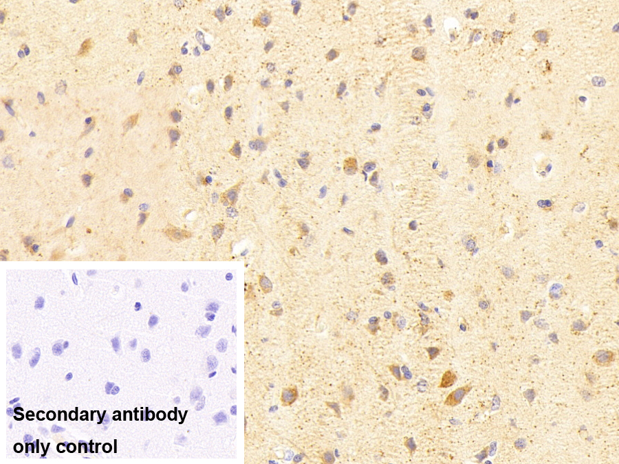 Polyclonal Antibody to Brain Derived Neurotrophic Factor (BDNF)