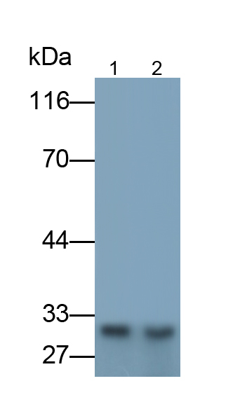 Polyclonal Antibody to Brain Derived Neurotrophic Factor (BDNF)