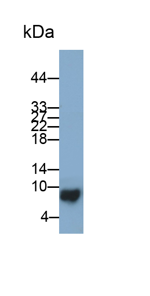 Polyclonal Antibody to S100 Calcium Binding Protein (S100)