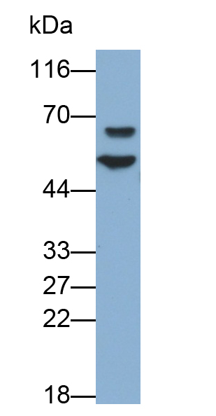 Polyclonal Antibody to Bone Morphogenetic Protein 2 (BMP2)