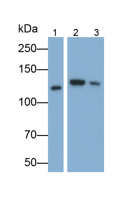 Polyclonal Antibody to E-cadherin