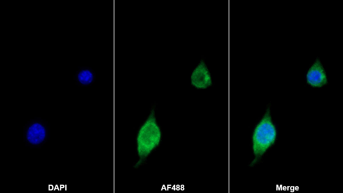 Polyclonal Antibody to Factor Related Apoptosis (FAS)