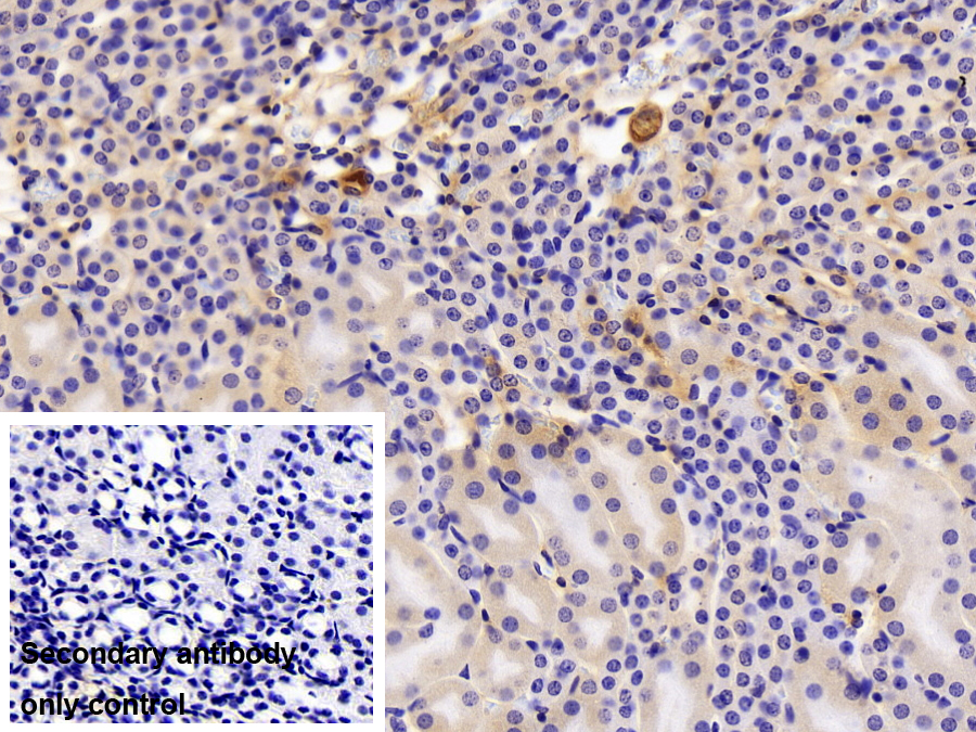 Polyclonal Antibody to Insulin Like Growth Factor 1 (IGF1)