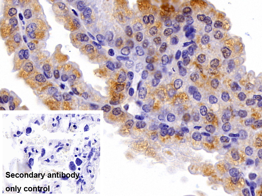 Polyclonal Antibody to Insulin Like Growth Factor 2 (IGF2)