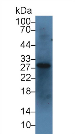 Polyclonal Antibody to Insulin Like Growth Factor Binding Protein 1 (IGFBP1)