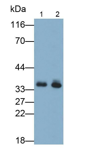 Polyclonal Antibody to Insulin Like Growth Factor Binding Protein 2 (IGFBP2)