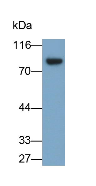 Polyclonal Antibody to Interleukin 1 Receptor Type I (IL1R1)