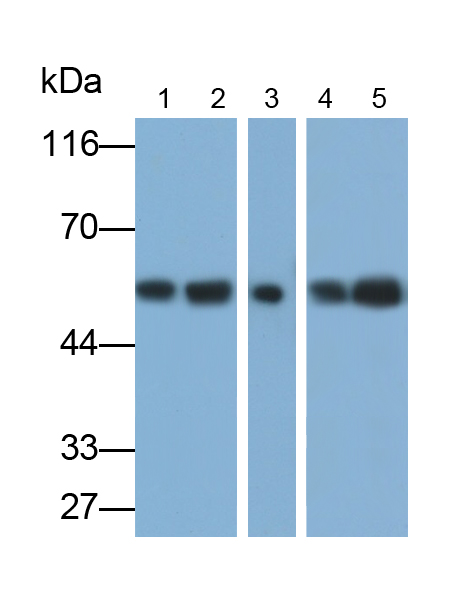 Polyclonal Antibody to Glial Fibrillary Acidic Protein (GFAP)