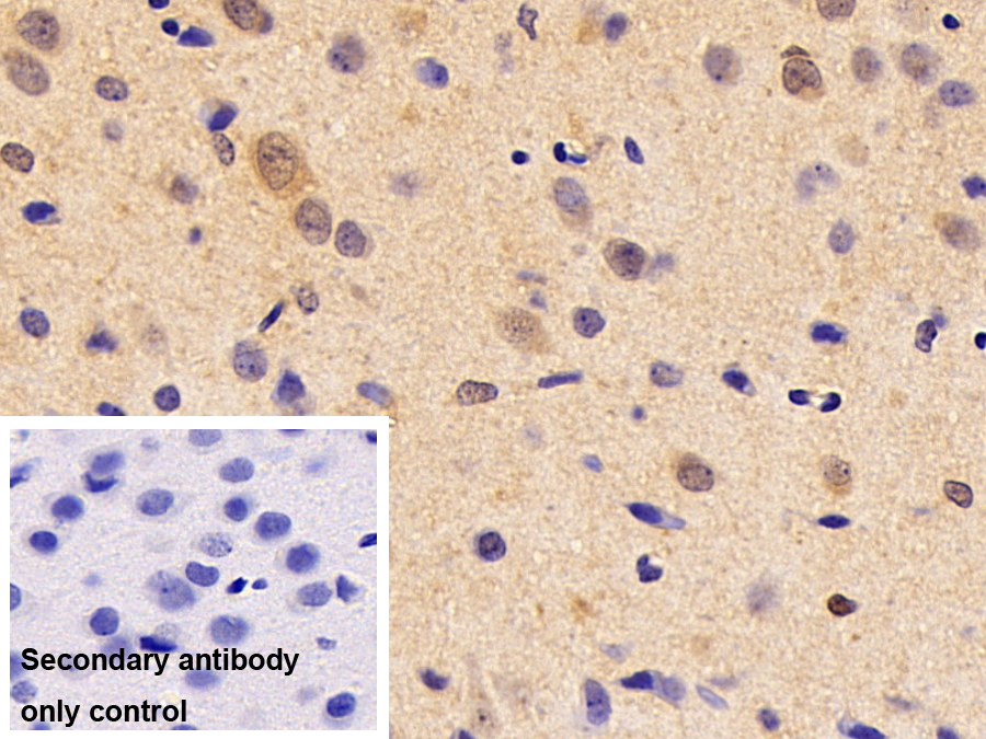 Polyclonal Antibody to Meningioma Expressed Antigen 5 (MGEA5)