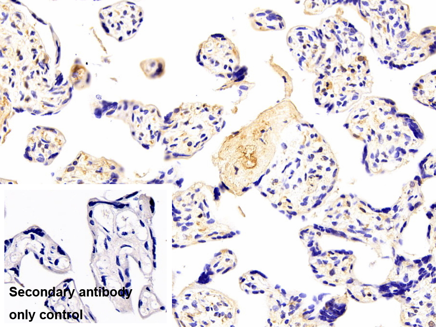 Polyclonal Antibody to Leptin (LEP)