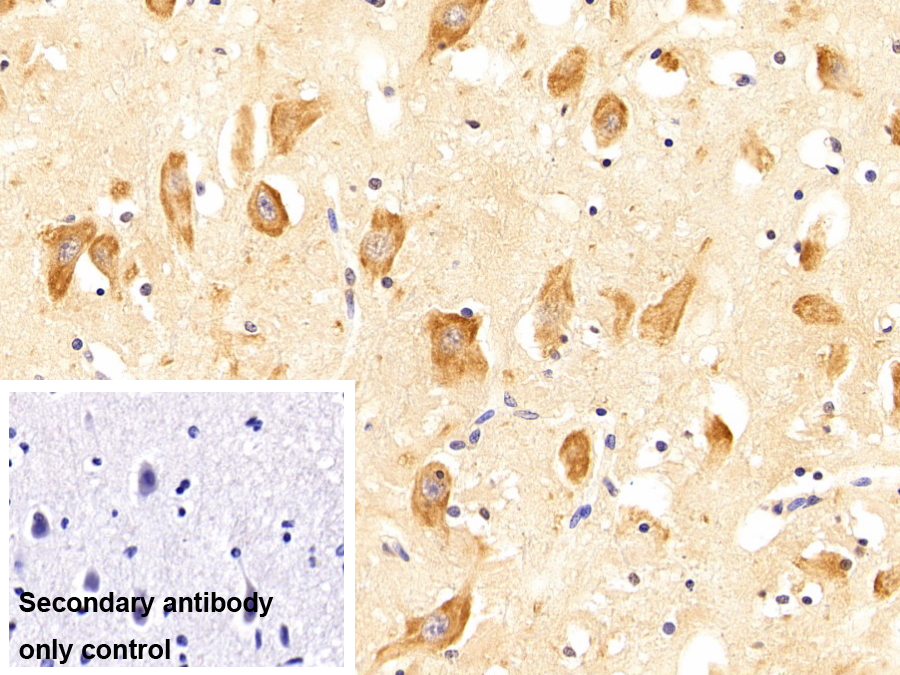 Polyclonal Antibody to Leptin (LEP)