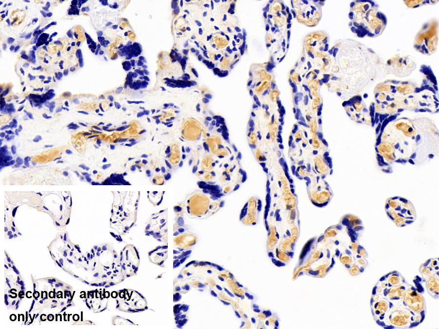 Polyclonal Antibody to Leptin (LEP)