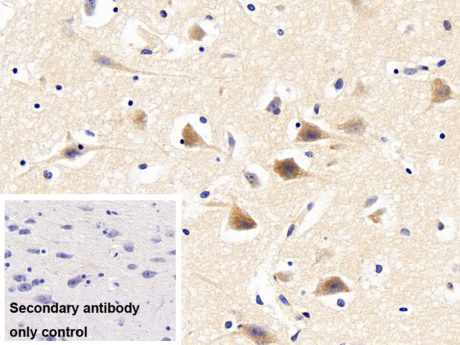 Polyclonal Antibody to Leptin (LEP)