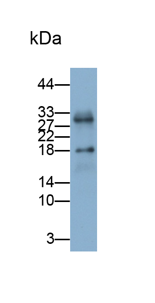 Polyclonal Antibody to Leptin (LEP)