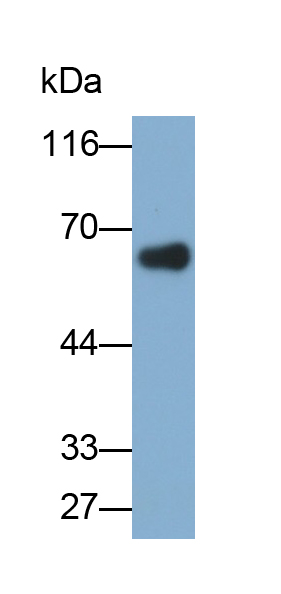 Polyclonal Antibody to Matrix Metalloproteinase 1 (MMP1)