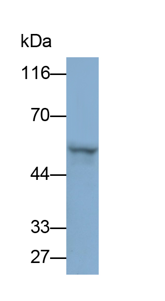 Polyclonal Antibody to Matrix Metalloproteinase 1 (MMP1)