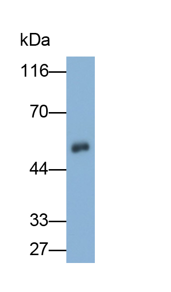 Polyclonal Antibody to Matrix Metalloproteinase 1 (MMP1)