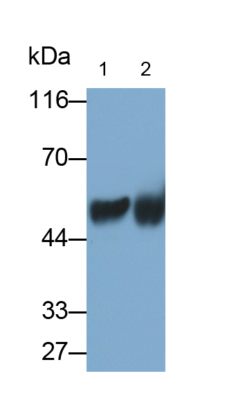 Polyclonal Antibody to Matrix Metalloproteinase 13 (MMP13)