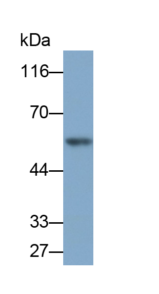 Polyclonal Antibody to Matrix Metalloproteinase 13 (MMP13)