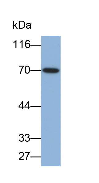 Polyclonal Antibody to Matrix Metalloproteinase 8 (MMP8)