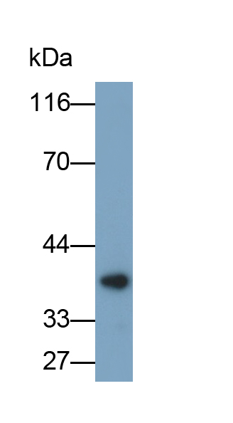 Polyclonal Antibody to Interleukin 12 (IL12)