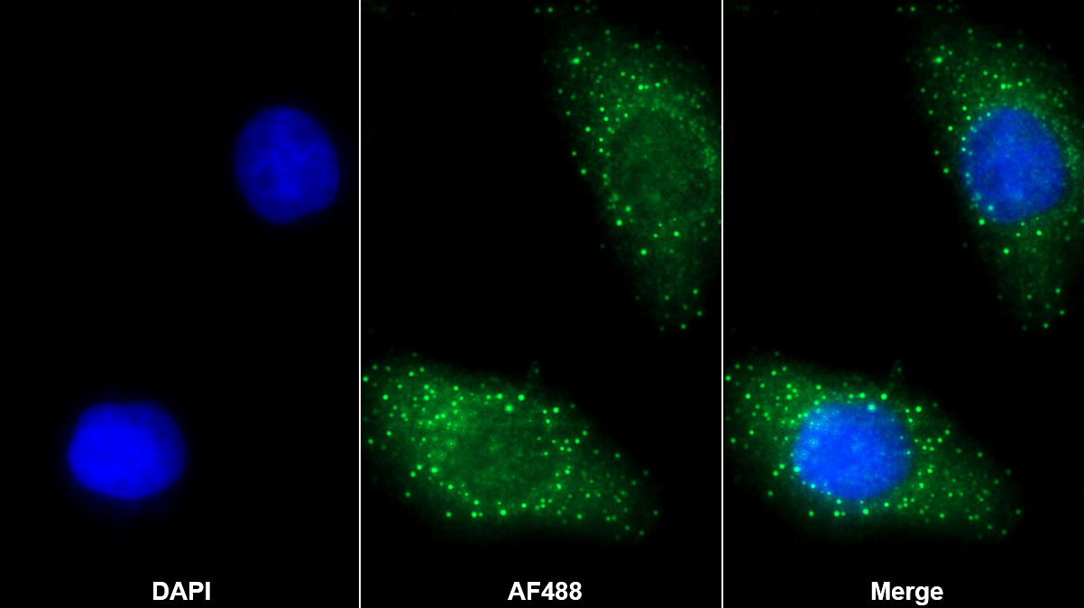 Polyclonal Antibody to Tissue Inhibitors Of Metalloproteinase 2 (TIMP2)