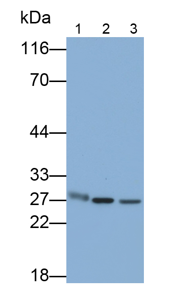 Polyclonal Antibody to Tissue Inhibitors Of Metalloproteinase 4 (TIMP4)