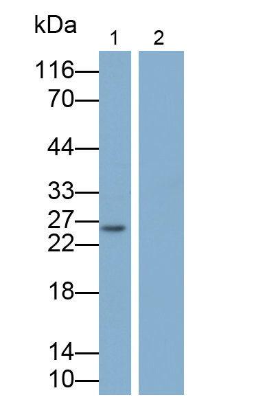 Polyclonal Antibody to Tumor Necrosis Factor Alpha (TNFa)