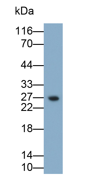 Polyclonal Antibody to Tumor Necrosis Factor Alpha (TNFa)