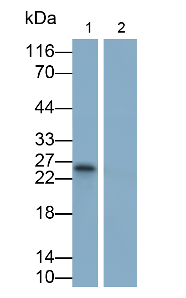 Polyclonal Antibody to Tumor Necrosis Factor Alpha (TNFa)