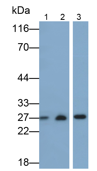 Polyclonal Antibody to Tumor Necrosis Factor Beta (TNFb)