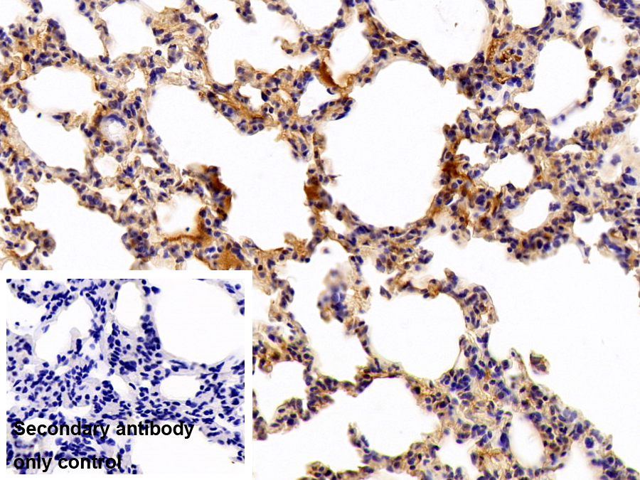 Polyclonal Antibody to Vascular Endothelial Growth Factor A (VEGFA)