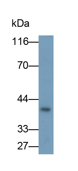 Polyclonal Antibody to Adiponectin Receptor 1 (ADIPOR1)