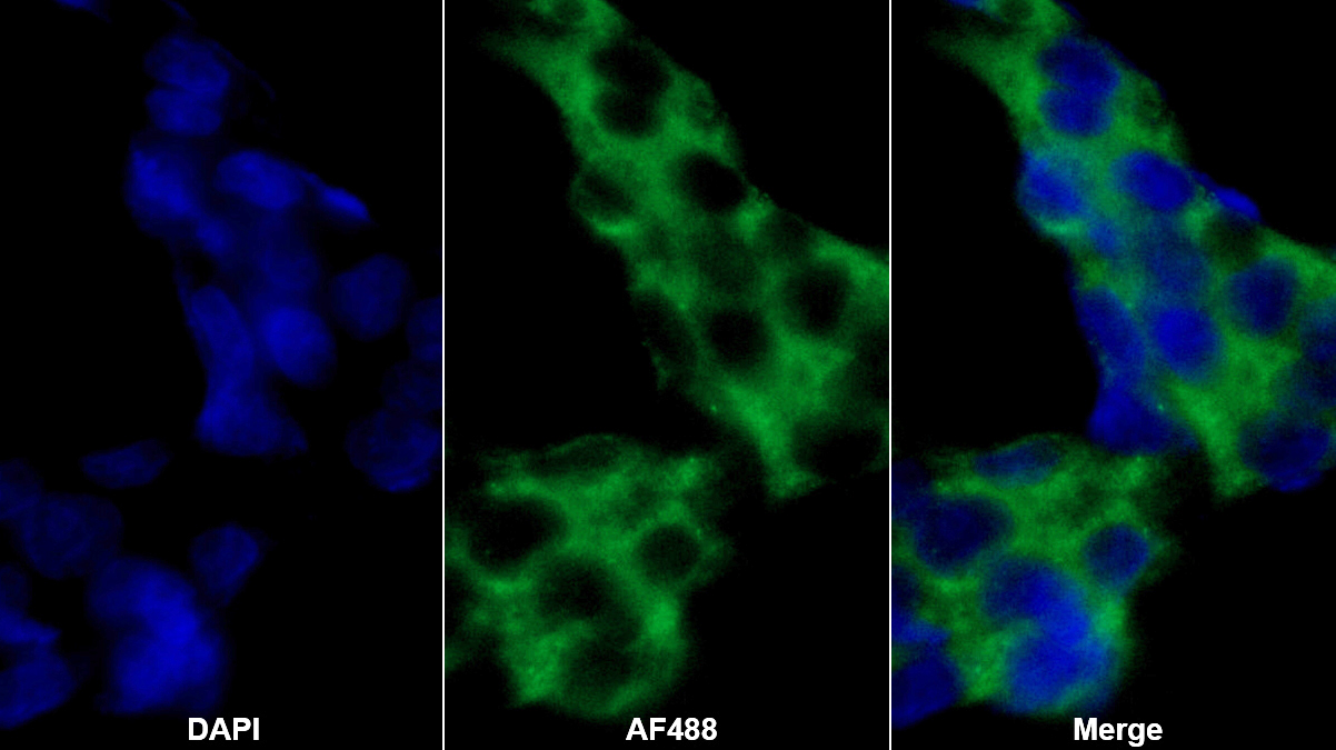 Polyclonal Antibody to Alpha 2-Antiplasmin (a2PI)