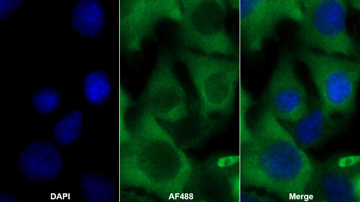 Polyclonal Antibody to Alpha 2-Antiplasmin (a2PI)