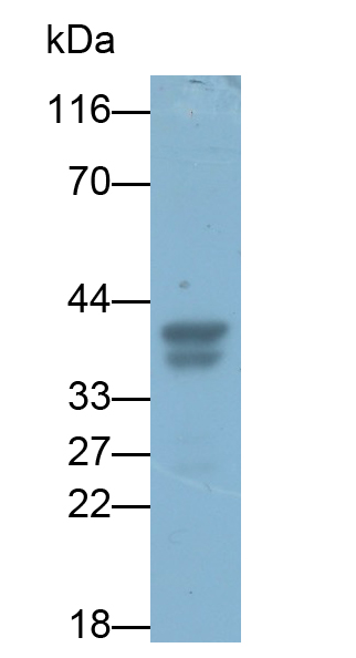 Polyclonal Antibody to Pepsinogen A (PGA)