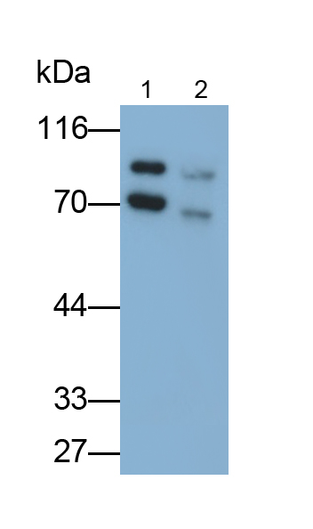 Polyclonal Antibody to Glucosidase Alpha, Acid (GaA)