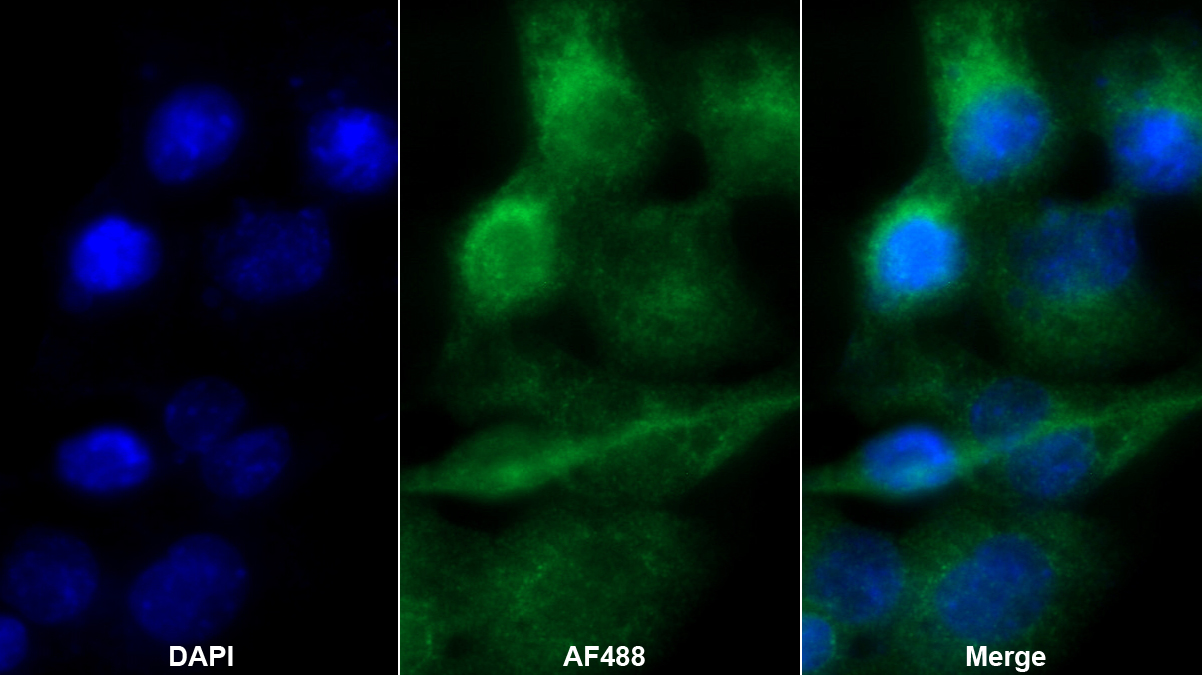 Polyclonal Antibody to Glucosidase Alpha, Acid (GaA)