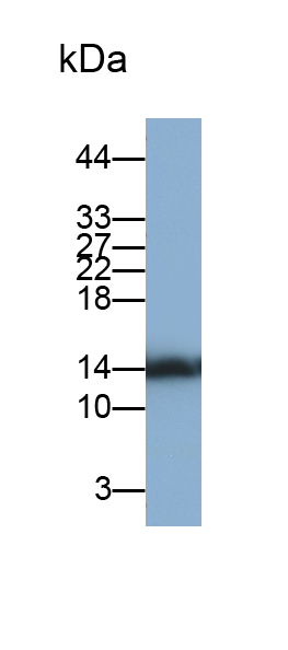Polyclonal Antibody to Glycated Hemoglobin A1c (HbA1c)