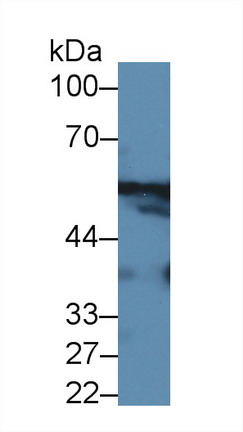 Polyclonal Antibody to Alanine Aminotransferase (ALT)