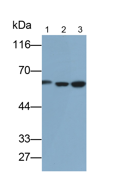 Polyclonal Antibody to Pyruvate kinase isozymes R/L (PKLR)