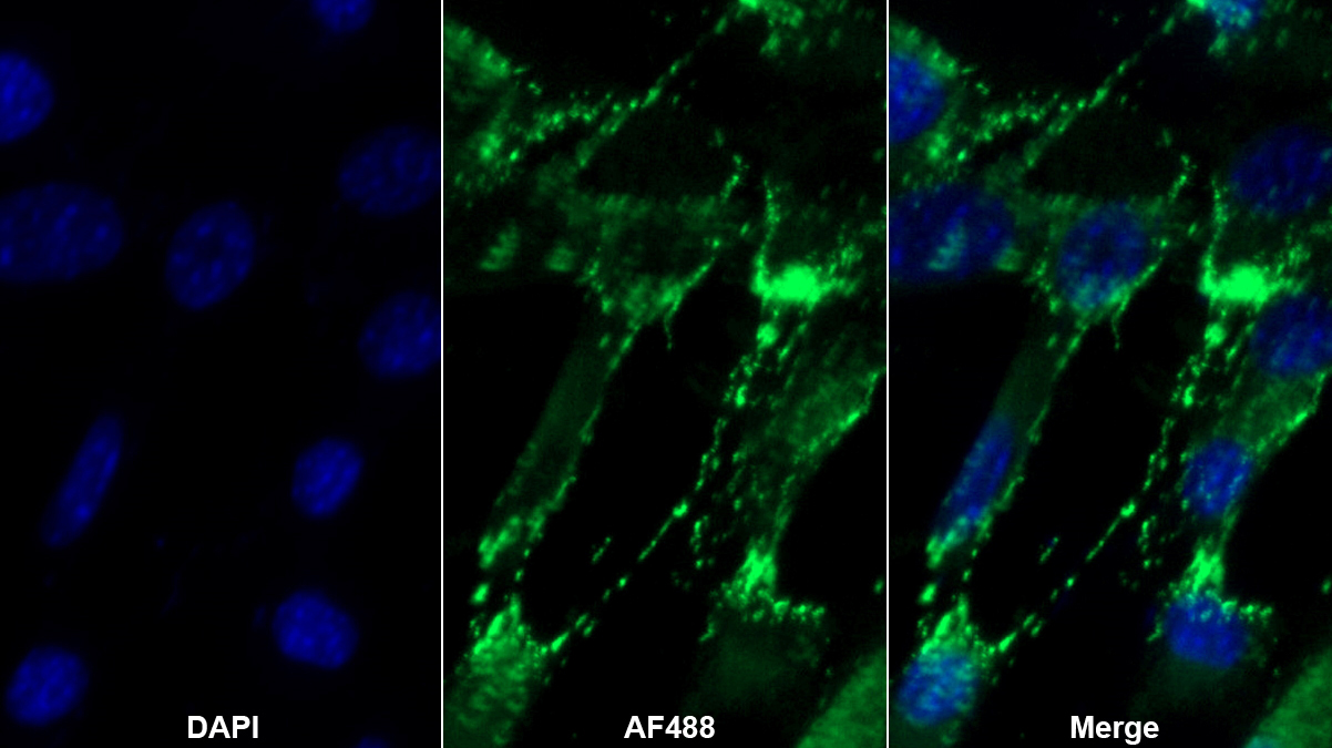 Polyclonal Antibody to Pyruvate kinase isozymes R/L (PKLR)
