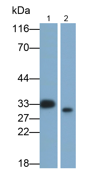 Polyclonal Antibody to Alpha-1-Microglobulin (a1M)